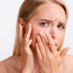 How To Prevent From Dry Skin