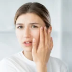 How to avoid dryness of face - skinoxy clinic