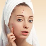 How To Get Rid Of Pimples Overnight ?